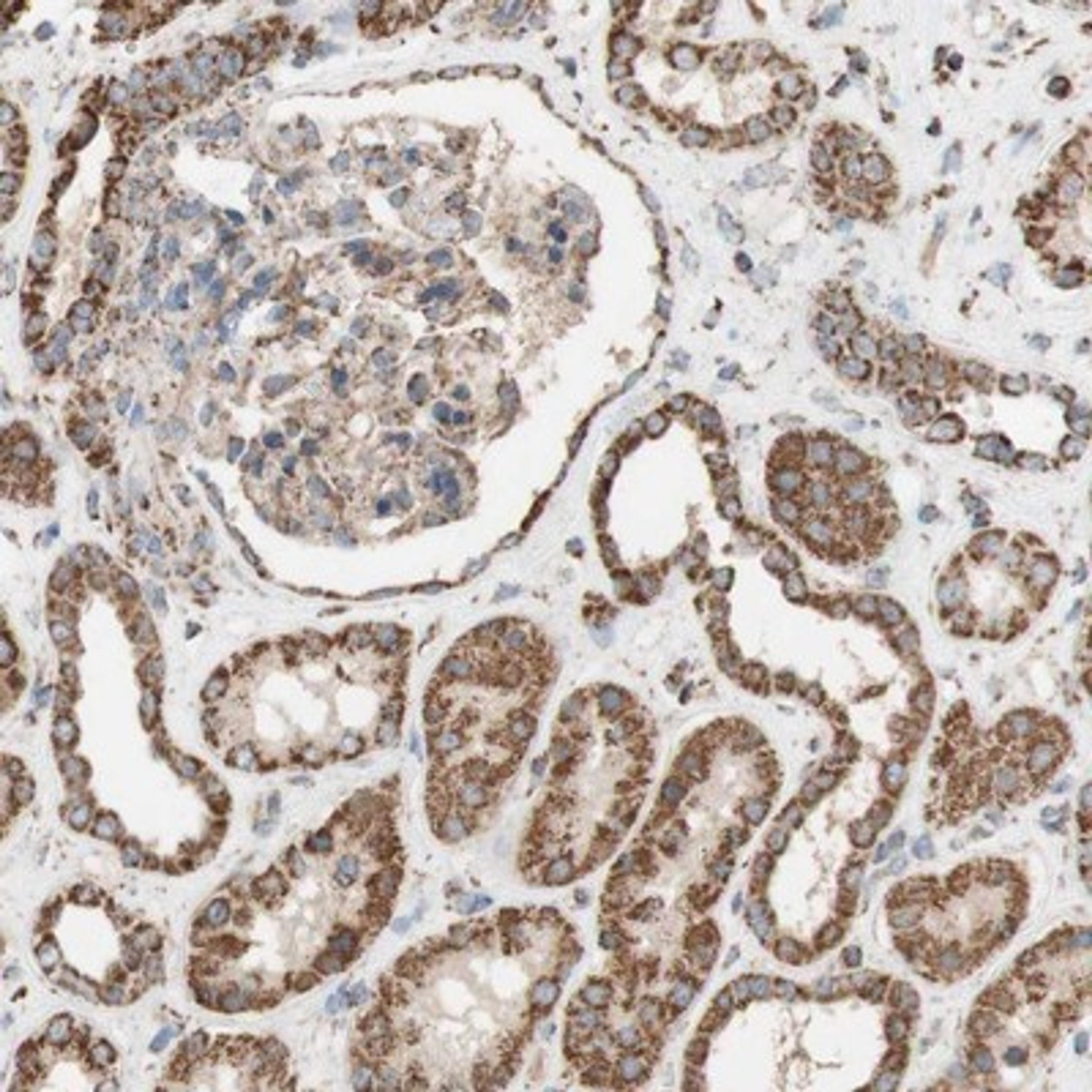 Immunohistochemistry-Paraffin: Synaptotagmin 12 Antibody [NBP1-87001] - Staining of human kidney shows strong granular cytoplasmic positivity in cells in tubules.