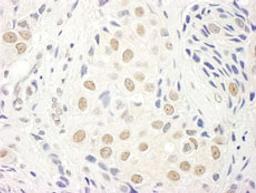 Detection of human TFIIS by immunohistochemistry.