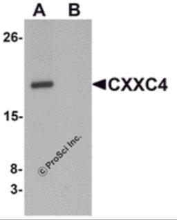 Western blot analysis of CXXC4 in human brain tissue lysate with CXXC4 antibody at 1 μg/mL in (A) the absence and (B) the presence of blocking peptide.