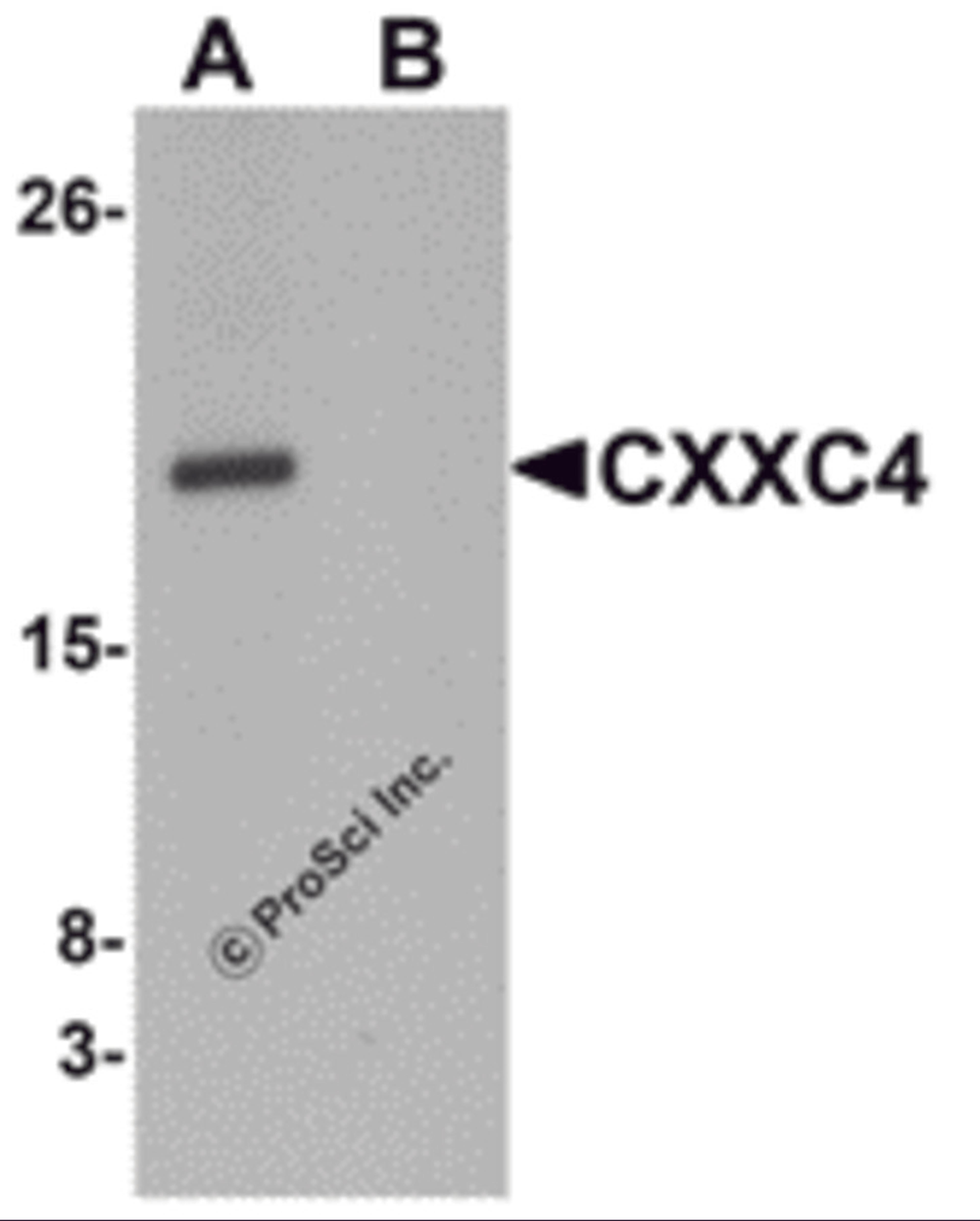 Western blot analysis of CXXC4 in human brain tissue lysate with CXXC4 antibody at 1 μg/mL in (A) the absence and (B) the presence of blocking peptide.