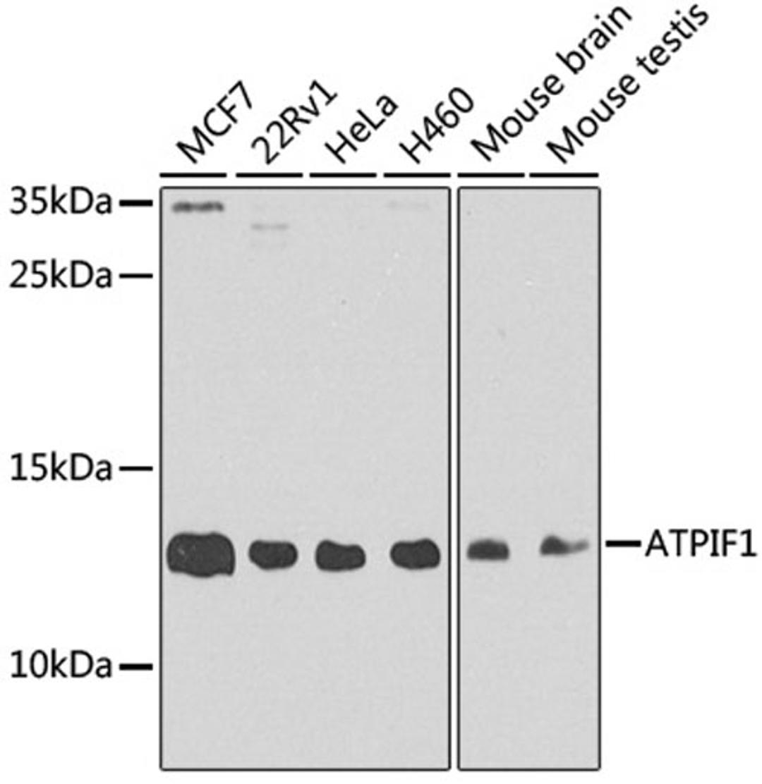 Western blot - ATPIF1 antibody (A5099)