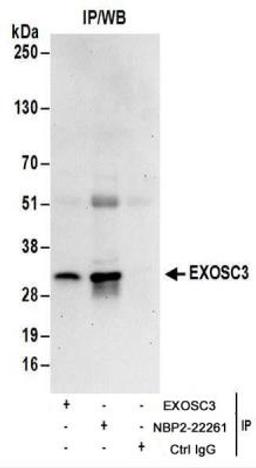 Immunoprecipitation: EXOSC3 Antibody [NBP2-22261] - Whole cell lysate (1 mg for IP; 20% of IP loaded) from 293T cells.  Antibodies:  NBP2-22261 used for IP at 6 ug/mg lysate.  EXOSC3 was also immunoprecipitated by another rabbit anti-EXOSC3 antibody.  For blotting immunoprecipitated EXOSC3, NBP2-22261 was used at 1 ug/ml.  Detection: Chemiluminescence with an exposure time of 30 seconds.