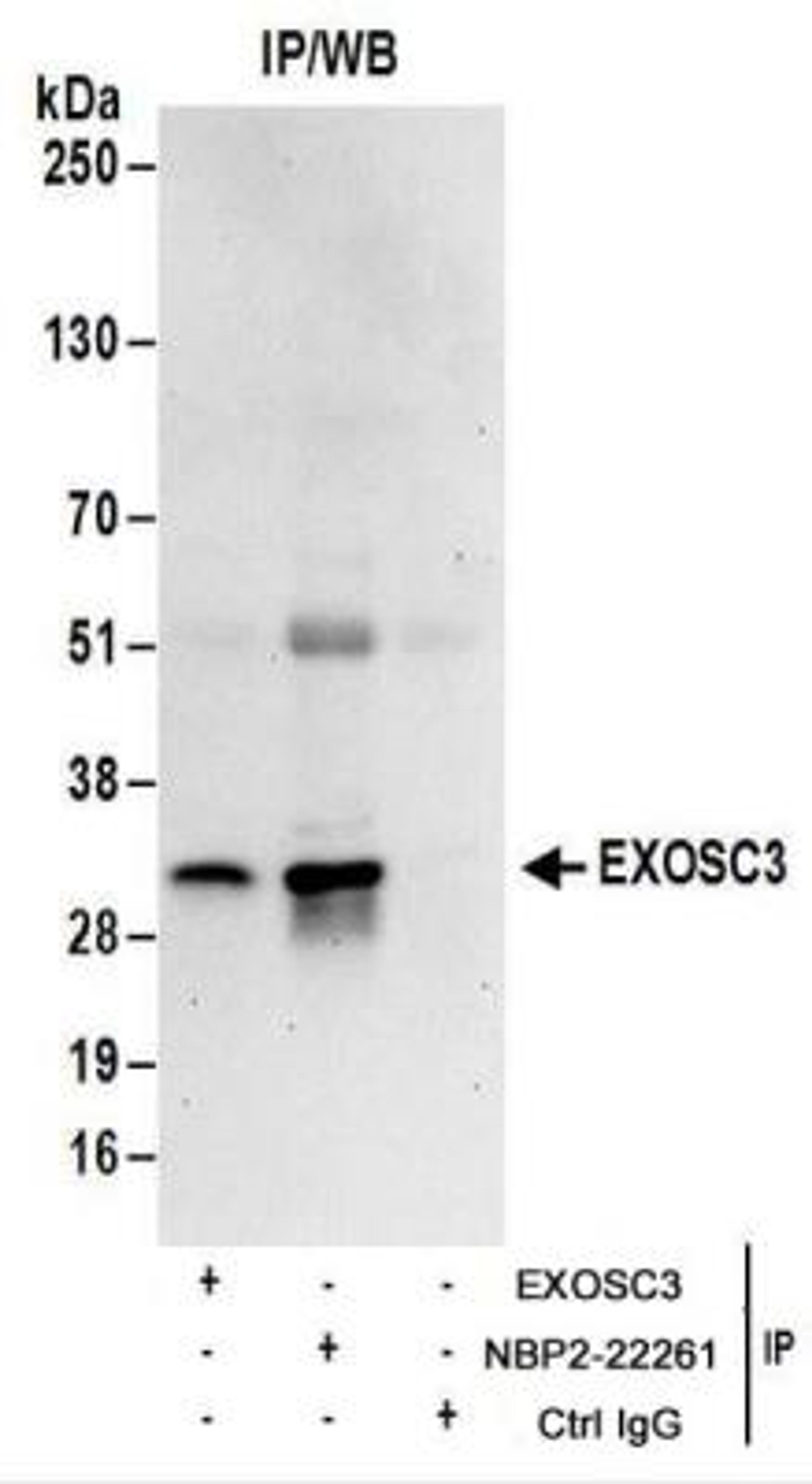 Immunoprecipitation: EXOSC3 Antibody [NBP2-22261] - Whole cell lysate (1 mg for IP; 20% of IP loaded) from 293T cells.  Antibodies:  NBP2-22261 used for IP at 6 ug/mg lysate.  EXOSC3 was also immunoprecipitated by another rabbit anti-EXOSC3 antibody.  For blotting immunoprecipitated EXOSC3, NBP2-22261 was used at 1 ug/ml.  Detection: Chemiluminescence with an exposure time of 30 seconds.