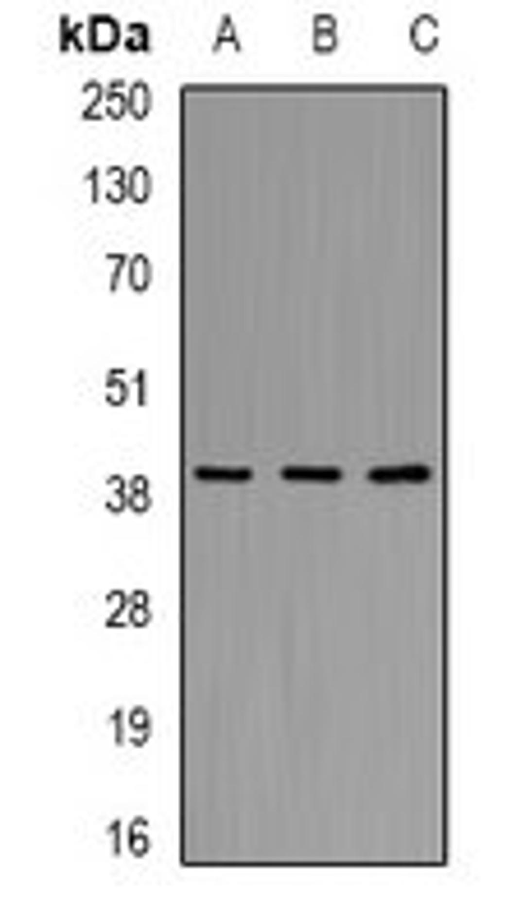 Western blot analysis of ES2 (Lane1), mouse kidney (Lane2), mouse liver (Lane3) whole cell lysates using AKR7A2 antibody