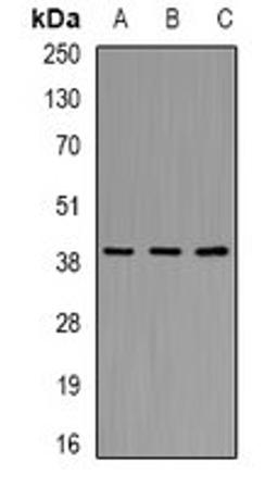 Western blot analysis of ES2 (Lane1), mouse kidney (Lane2), mouse liver (Lane3) whole cell lysates using AKR7A2 antibody