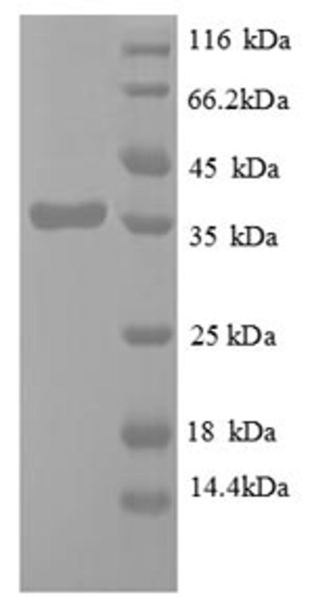 (Tris-Glycine gel) Discontinuous SDS-PAGE (reduced) with 5% enrichment gel and 15% separation gel.