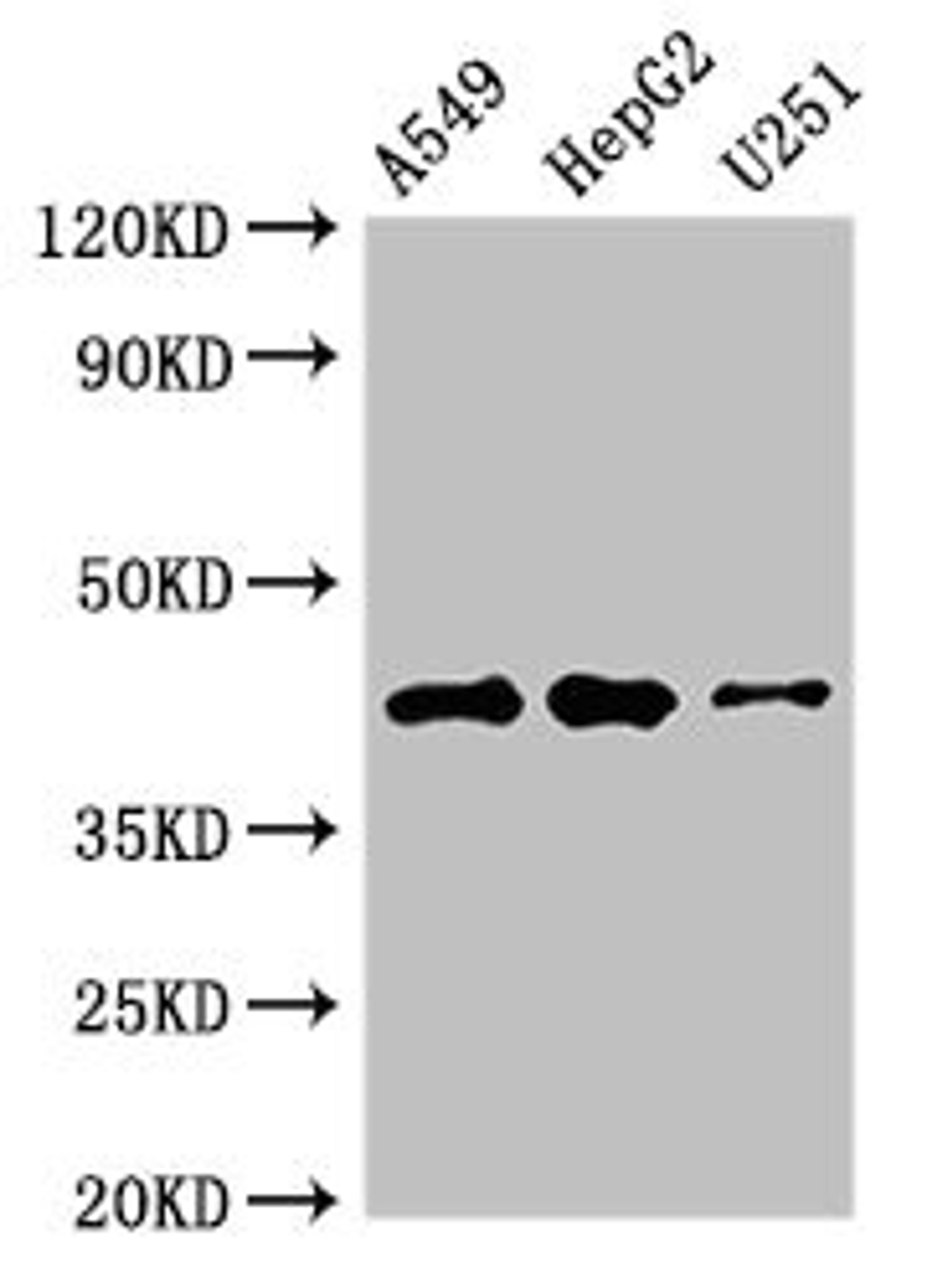 Western Blot. Positive WB detected in: A549 whole cell lysate, HepG2 whole cell lysate, U251 whole cell lysate. All lanes: B4GALT2 antibody at 3.5µg/ml. Secondary. Goat polyclonal to rabbit IgG at 1/50000 dilution. Predicted band size: 42, 35, 45 kDa. Observed band size: 42 kDa