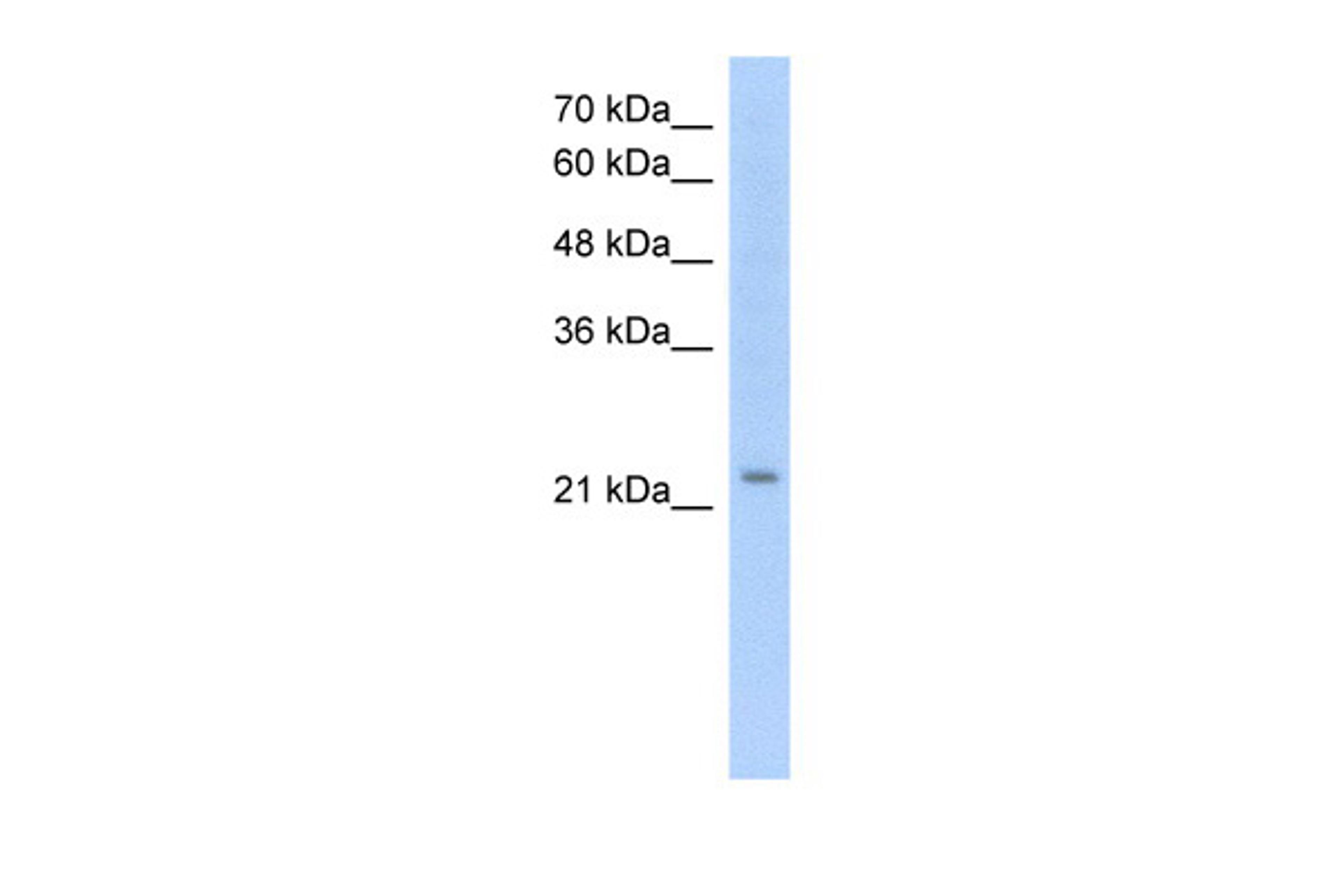 Antibody used in WB on Human HepG2 at 1.25 ug/ml.