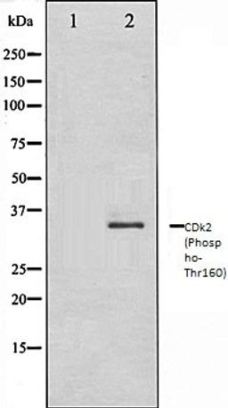 Western blot analysis of A2780 whole cell lysates using CDK2 (Phospho-Thr160) antibody, The lane on the left is treated with the antigen-specific peptide.