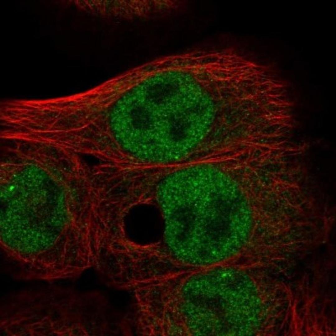 Immunocytochemistry/Immunofluorescence: FAM54B Antibody [NBP1-86401] - Immunofluorescent staining of human cell line A-431 shows positivity in nucleus but not nucleoli.