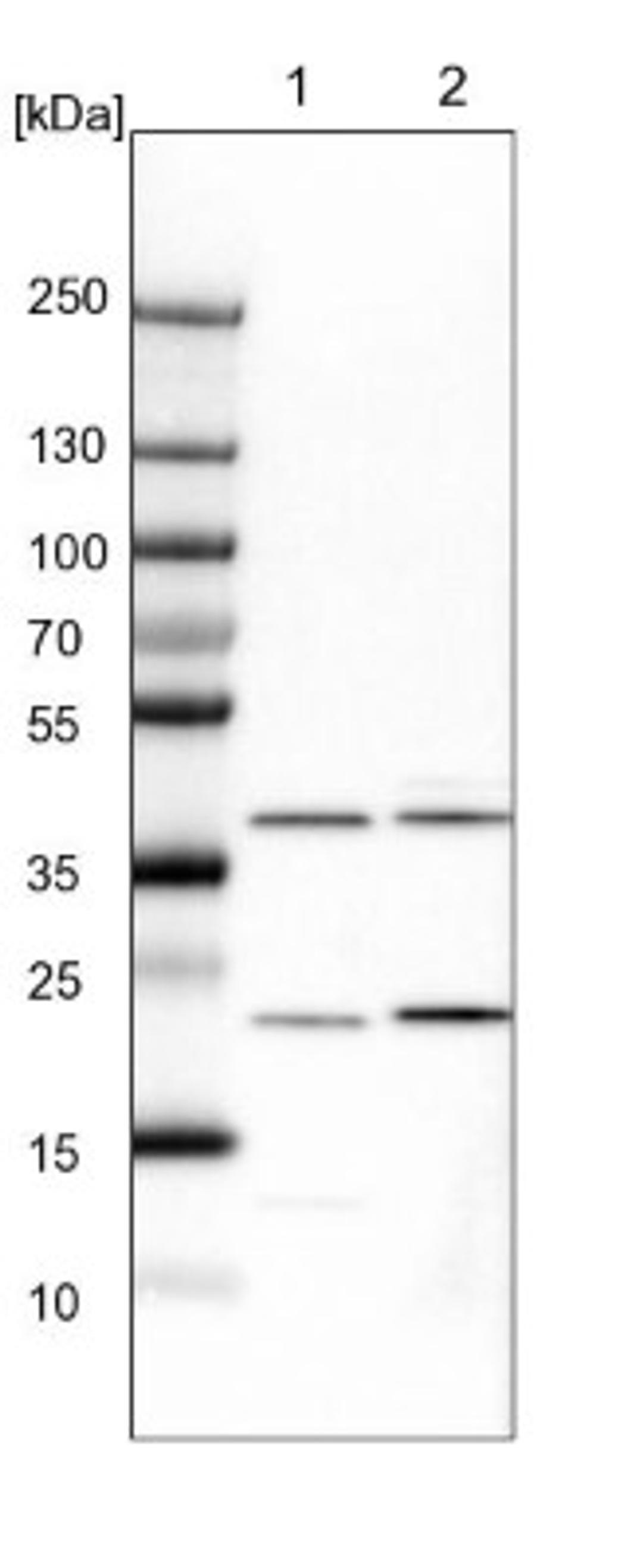 Western Blot: Calponin 1 Antibody [NBP1-87029] - Lane 1: NIH-3T3 cell lysate (Mouse embryonic fibroblast cells)<br/>Lane 2: NBT-II cell lysate (Rat Wistar bladder tumour cells)