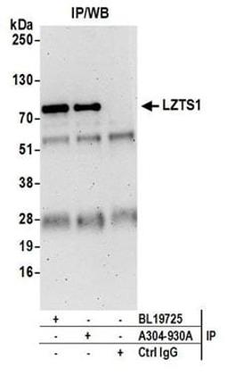 Detection of human LZTS1 by western blot of immunoprecipitates.