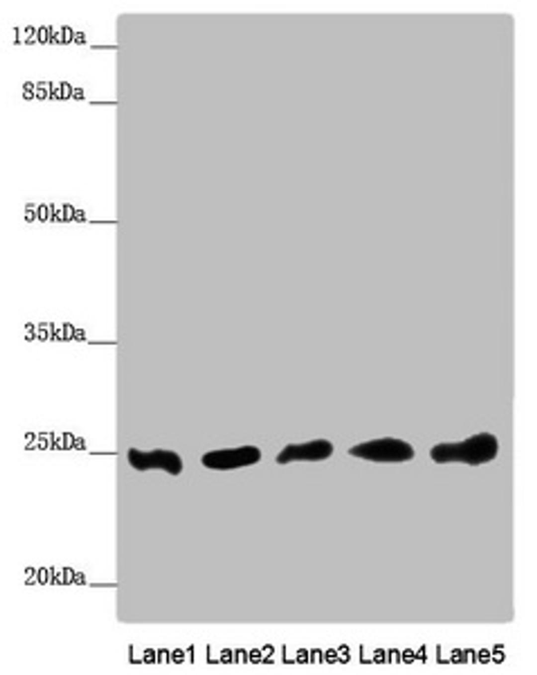 Western blot. All lanes: EEF1B2 antibody at 0.91 ug/ml. Lane 1: PC-3 whole cell lysate. Lane 2: 293T whole cell lysate. Lane 3: Hela whole cell lysate. Lane 4: Jurkat whole cell lysate. Lane 5: Raw264.7 whole cell lysate. Secondary. Goat polyclonal to rabbit IgG at 1/10000 dilution. Predicted band size: 25 kDa. Observed band size: 25 kDa.