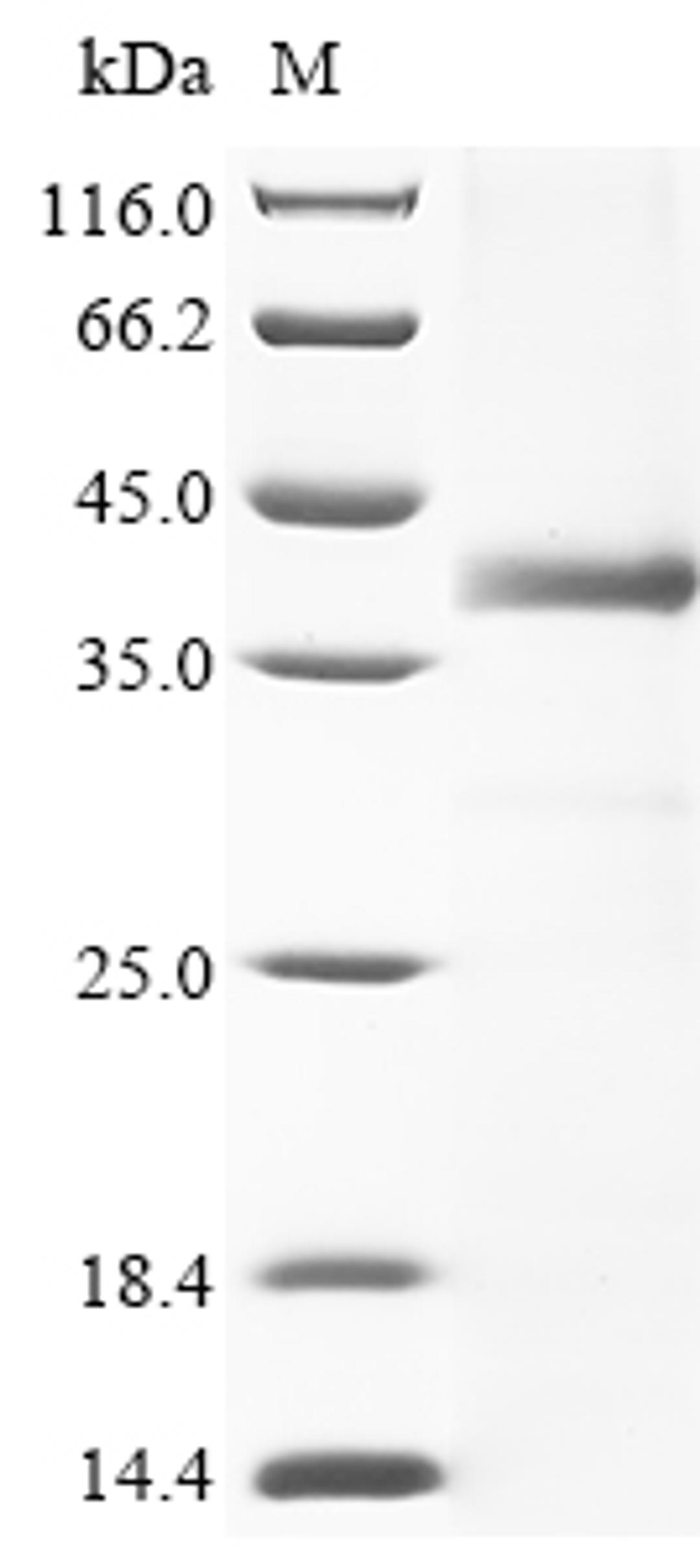 (Tris-Glycine gel) Discontinuous SDS-PAGE (reduced) with 5% enrichment gel and 15% separation gel.