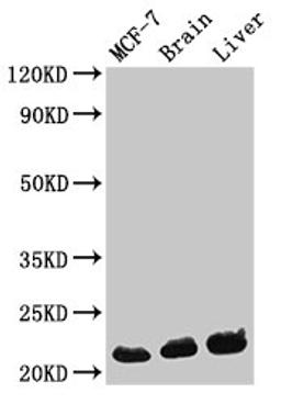 Western Blot. Positive WB detected in: MCF-7 whole cell lysate, Mouse brain tissue, Mouse liver tissue. All lanes: HIST1H1C antibody at 0.3µg/ml. Secondary. Goat polyclonal to rabbit IgG at 1/50000 dilution. Predicted band size: 22 kDa. Observed band size: 22 kDa