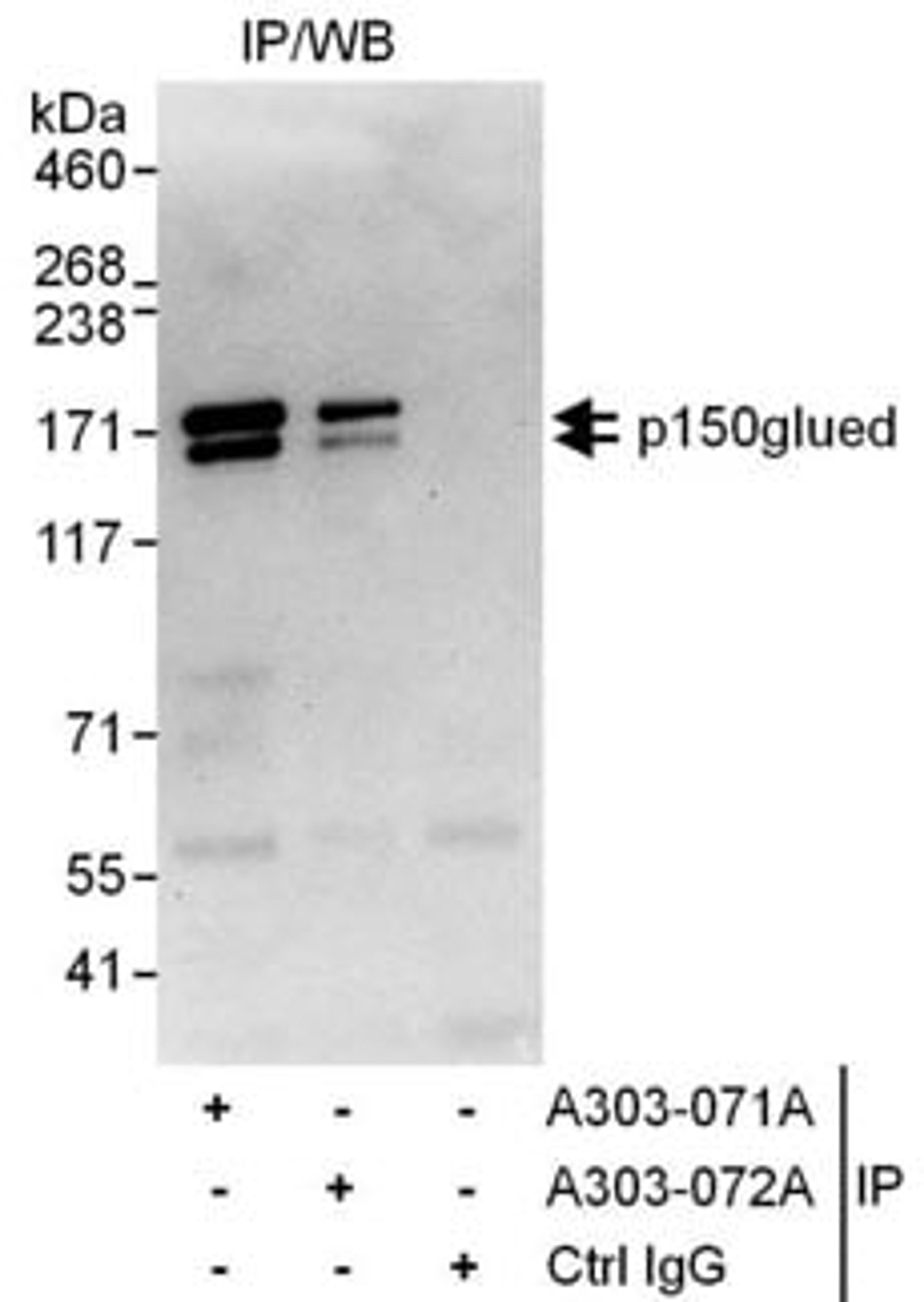 Detection of human p150glued by western blot of immunoprecipitates.