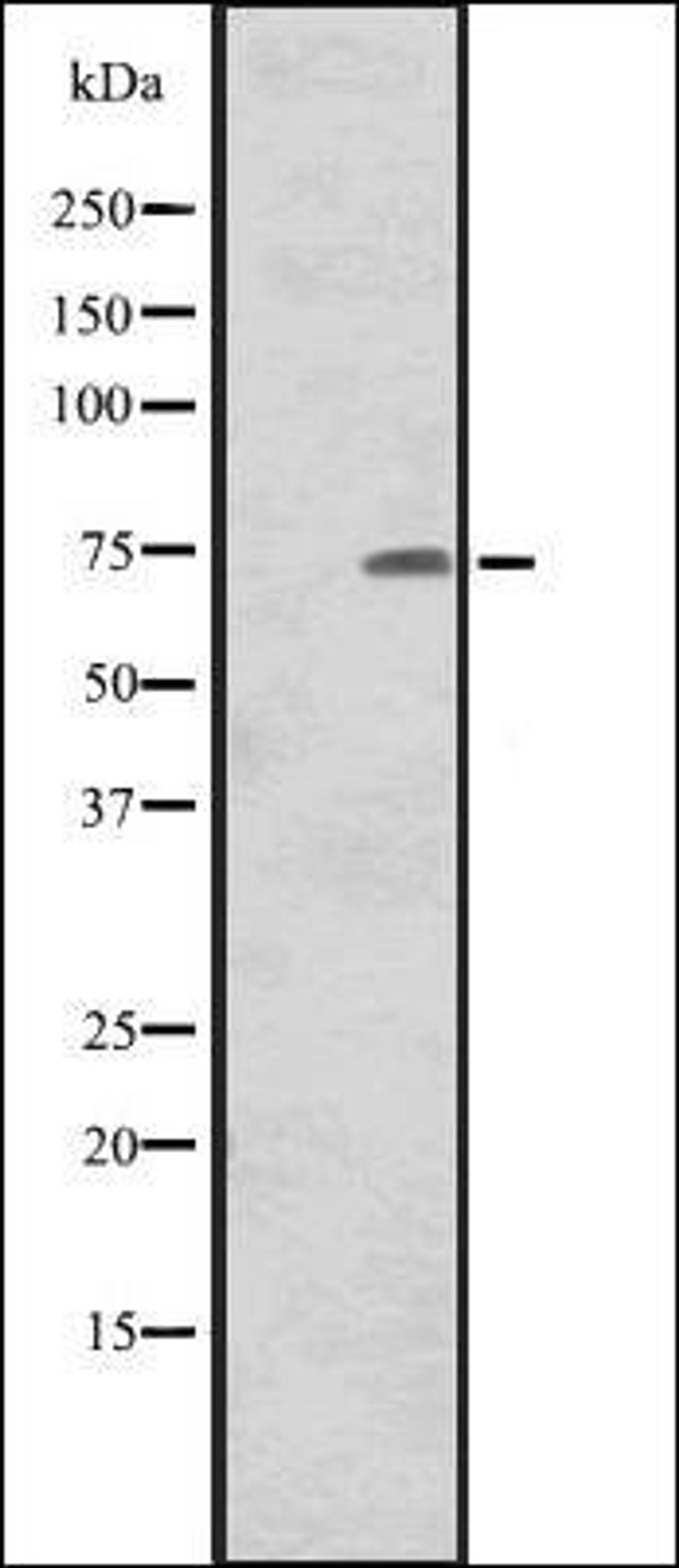 Western blot analysis of Human tonsil tissue lysate using CNNM1 antibody