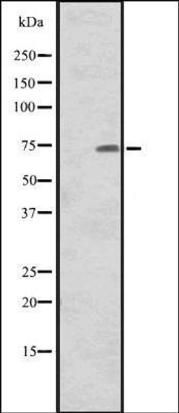 Western blot analysis of Human tonsil tissue lysate using CNNM1 antibody