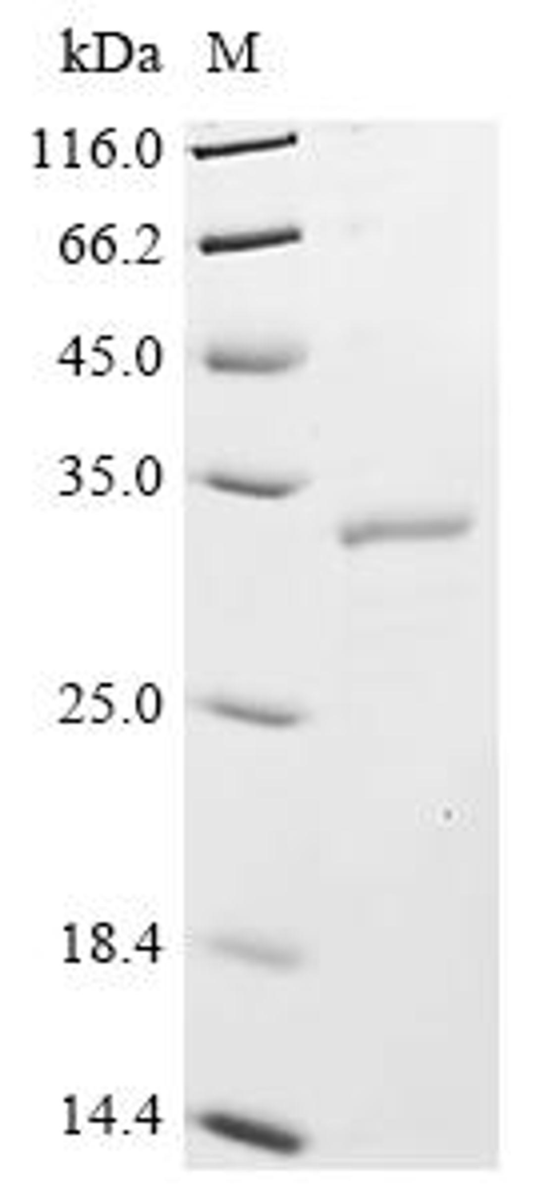 (Tris-Glycine gel) Discontinuous SDS-PAGE (reduced) with 5% enrichment gel and 15% separation gel.