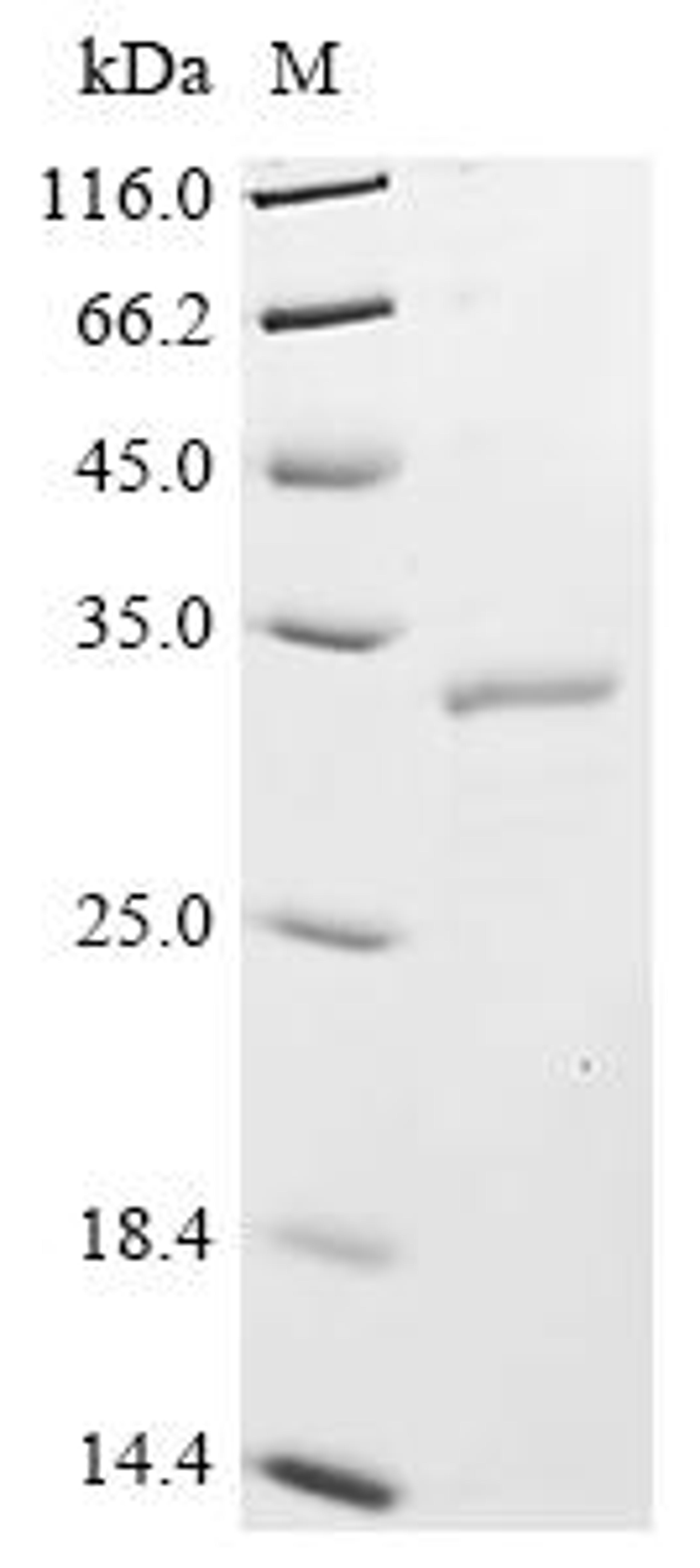 (Tris-Glycine gel) Discontinuous SDS-PAGE (reduced) with 5% enrichment gel and 15% separation gel.