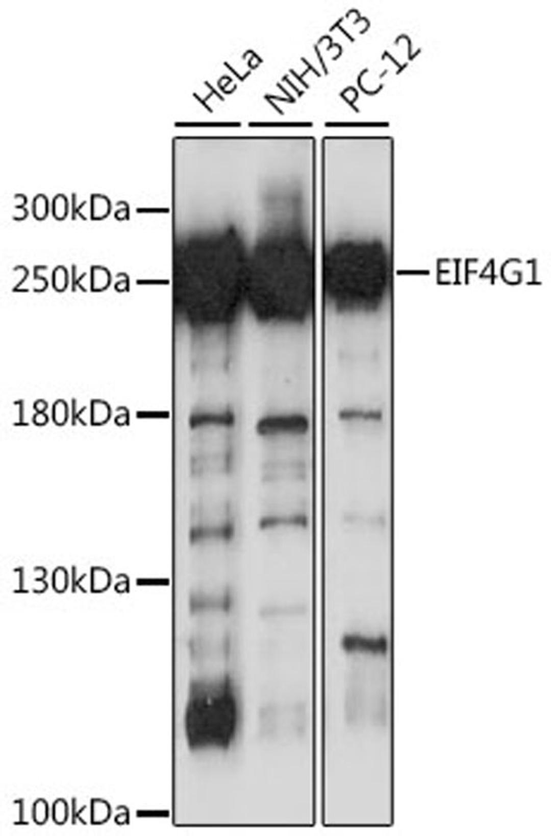 Western blot - EIF4G antibody (A0881)