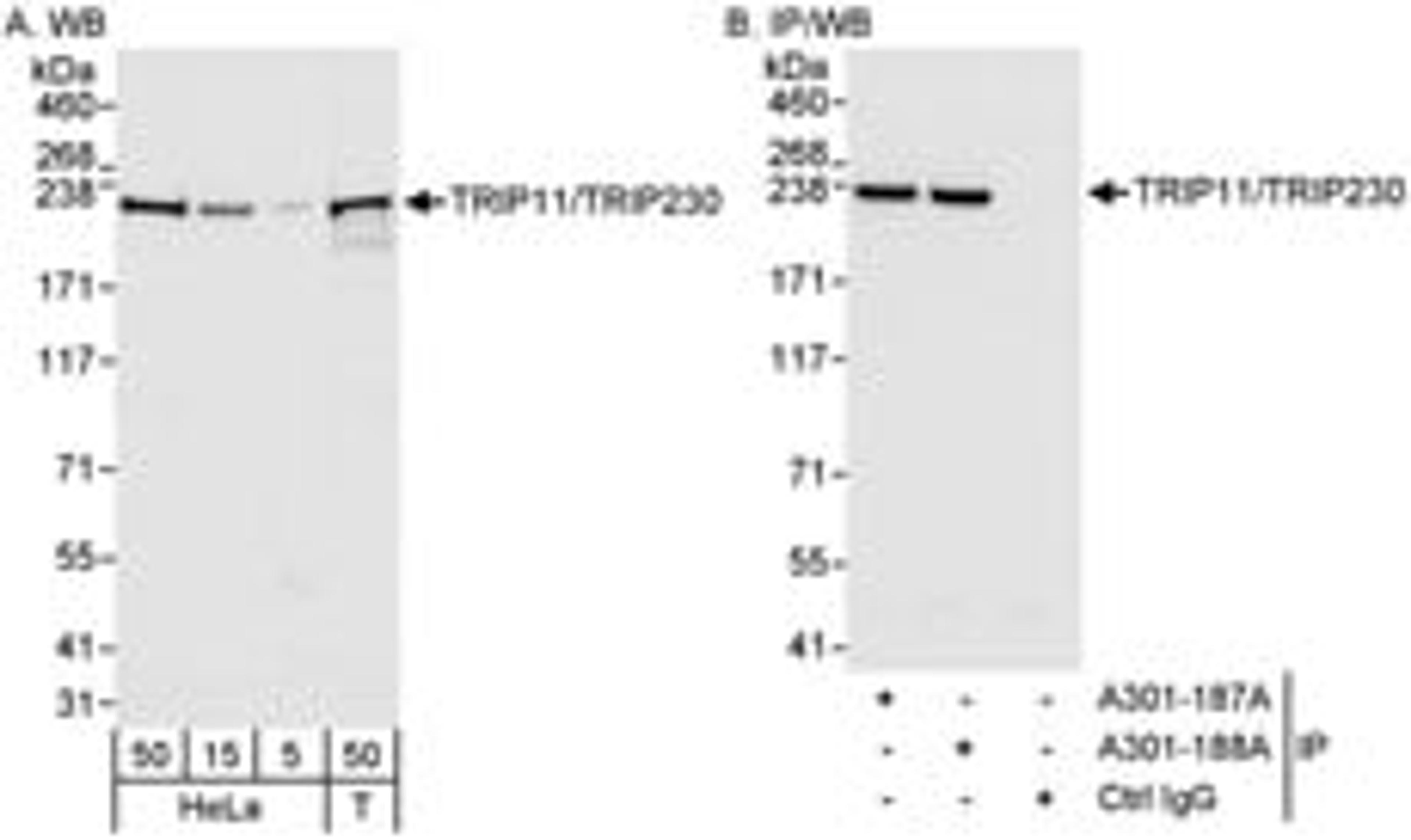 Detection of human TRIP11/TRIP230 by western blot and immunoprecipitation.