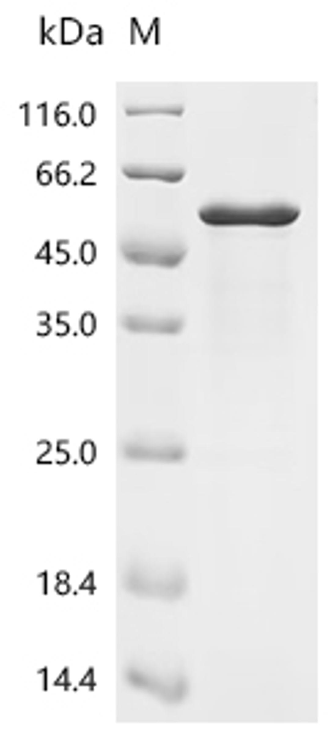 (Tris-Glycine gel) Discontinuous SDS-PAGE (reduced) with 5% enrichment gel and 15% separation gel.