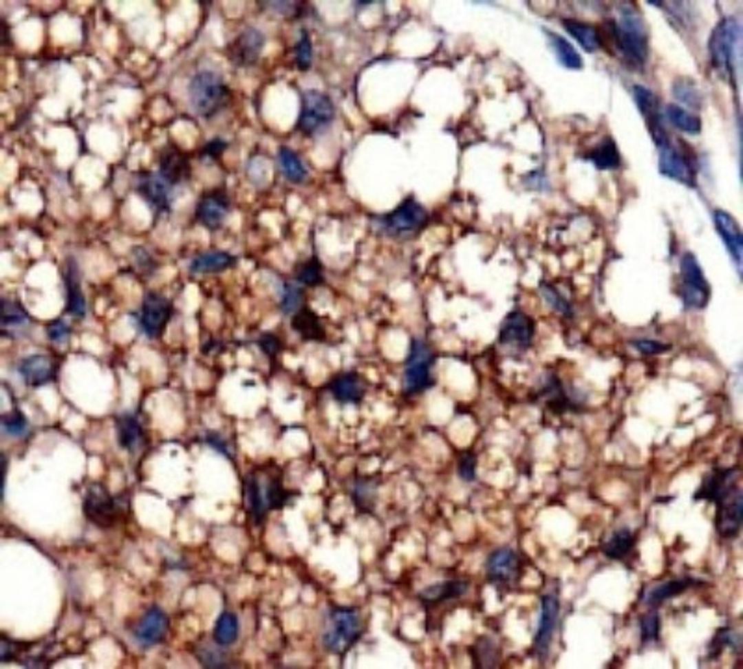 Immunohistochemistry: OXPAT Antibody [NB110-60509] - Staining of OXPAT in paraffin embedded mouse fat.