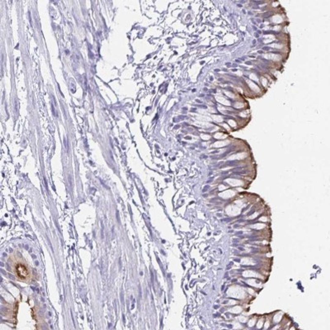 Immunohistochemistry: TCTEX1D4 Antibody [NBP2-32366] - Staining of human bronchus shows moderate positivity in cilia of respiratory epithelial cells.