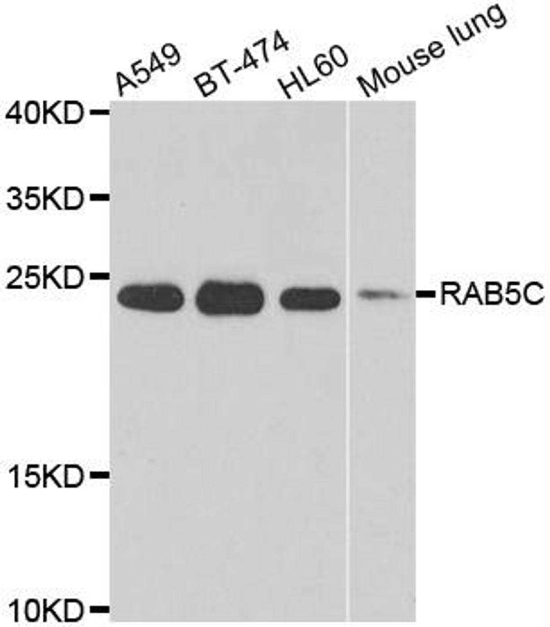 Western blot analysis of extracts of various cell lines using RAB5C antibody