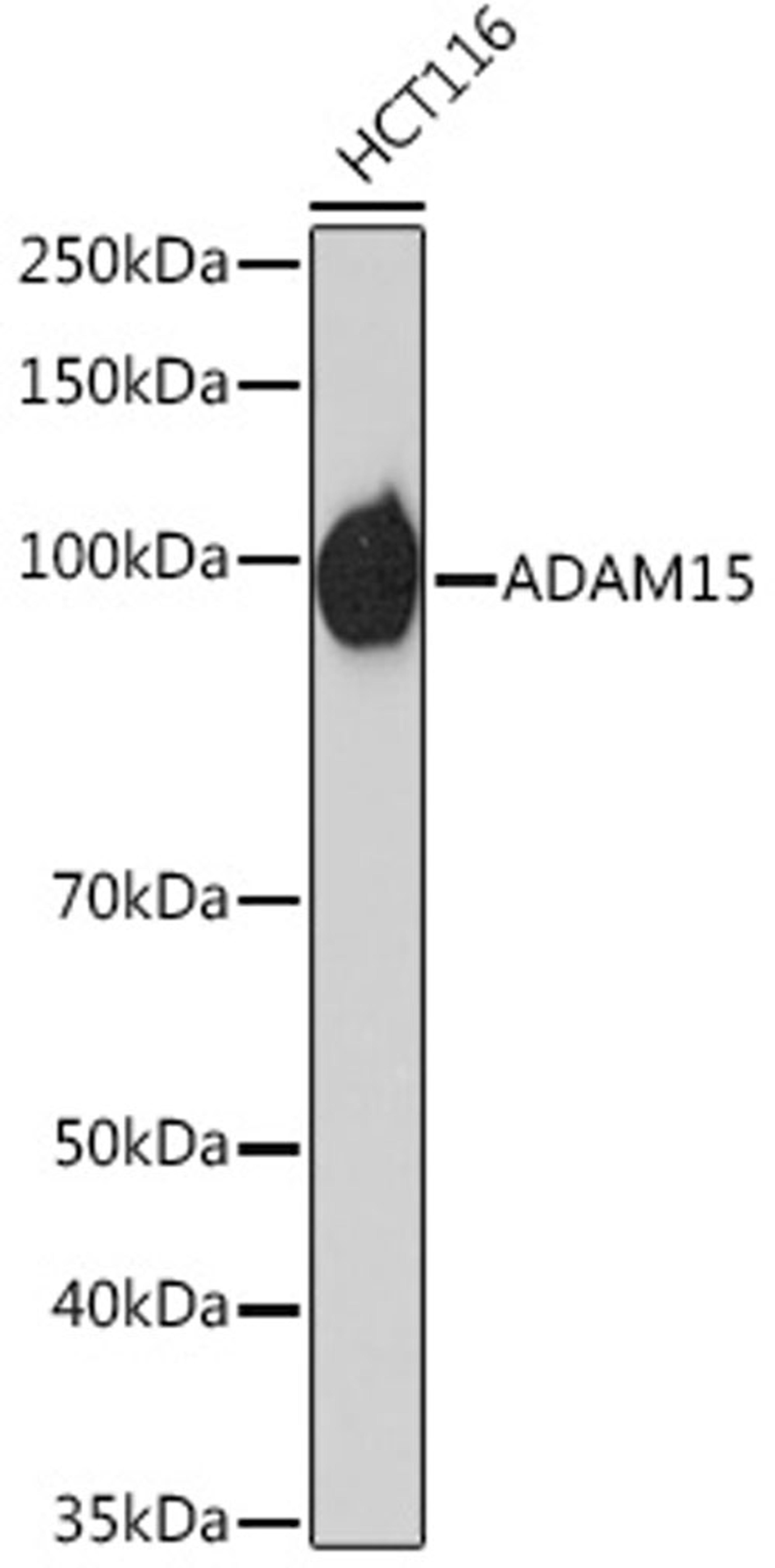 Western blot - ADAM15 Rabbit mAb (A6813)