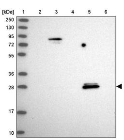 Western Blot: SPIN4 Antibody [NBP1-93750] - Lane 1: Marker [kDa] 250, 130, 95, 72, 55, 36, 28, 17, 10<br/>Lane 2: Human cell line RT-4<br/>Lane 3: Human cell line U-251MG sp<br/>Lane 4: Human plasma (IgG/HSA depleted)<br/>Lane 5: Human liver tissue<br/>Lane 6: Human tonsil tissue