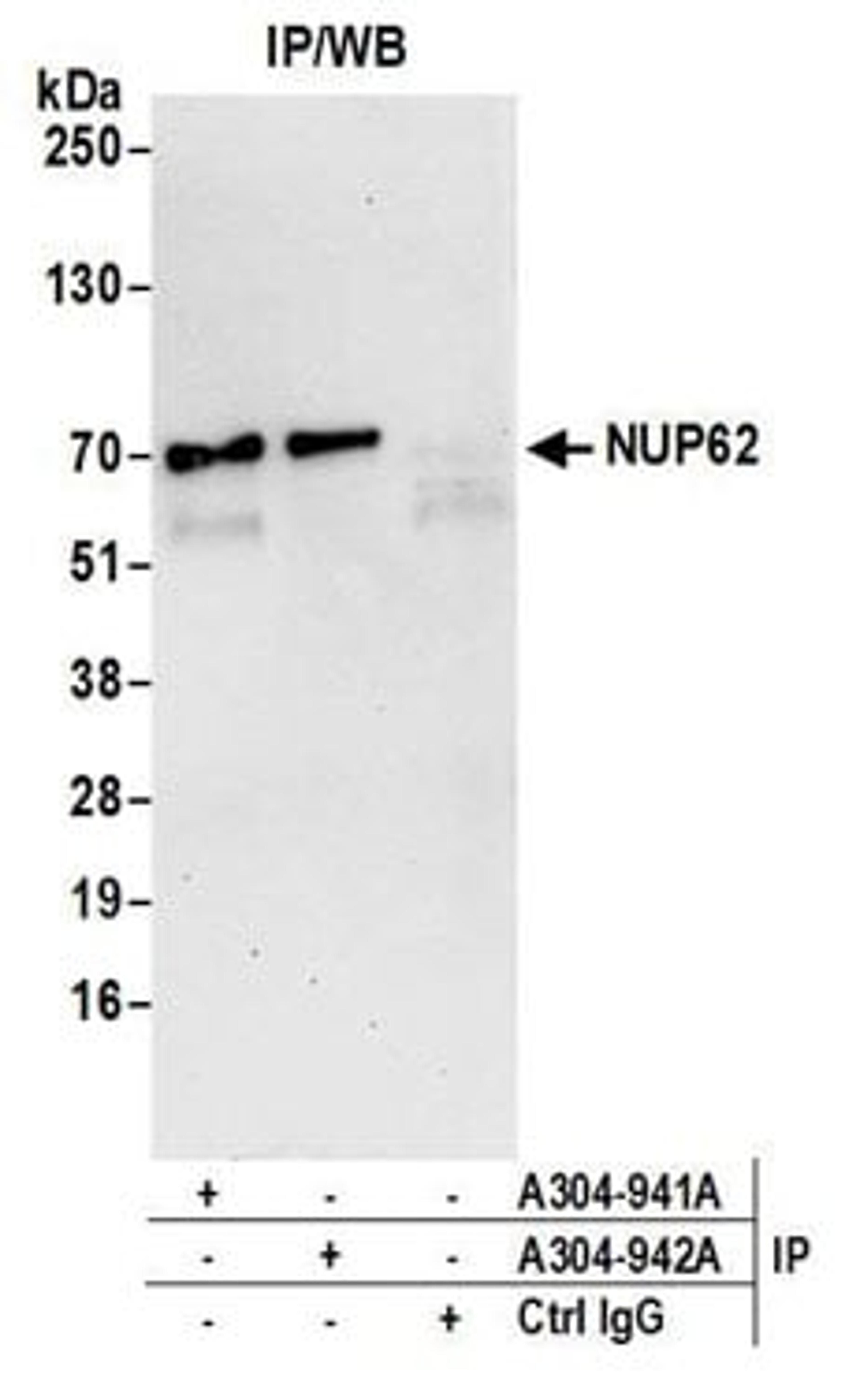 Detection of human NUP62 by western blot of immunoprecipitates.