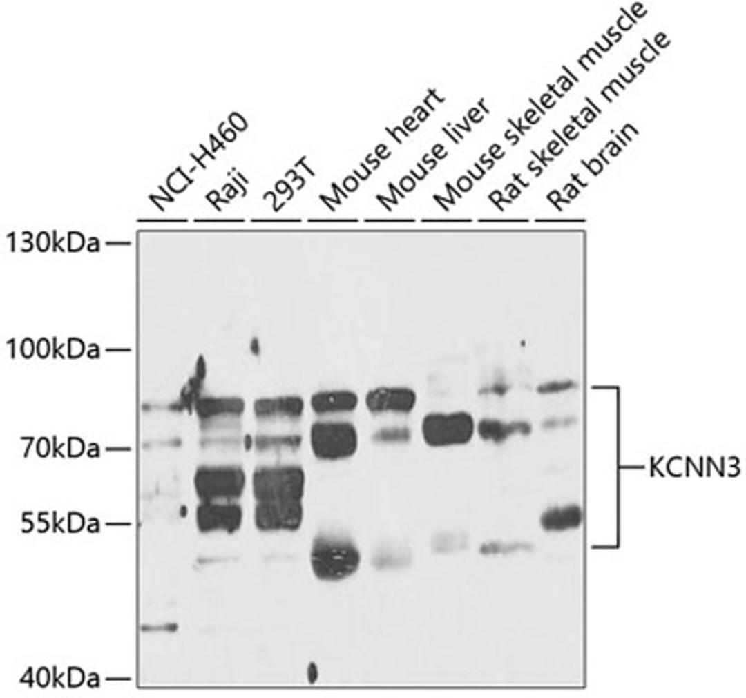 Western blot - KCNN3 antibody (A14012)