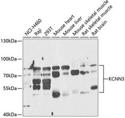 Western blot - KCNN3 antibody (A14012)