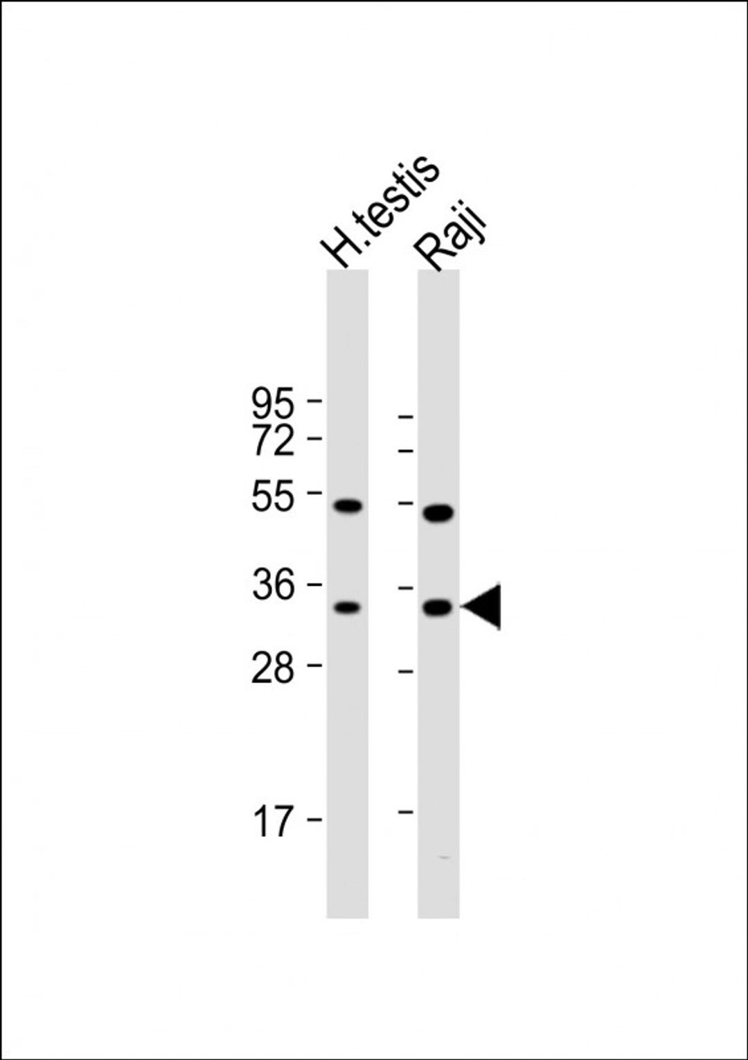 Western Blot at 1:1000 dilution Lane 1: human testis lysate Lane 2: Raji whole cell lysate Lysates/proteins at 20 ug per lane.