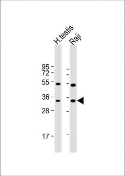 Western Blot at 1:1000 dilution Lane 1: human testis lysate Lane 2: Raji whole cell lysate Lysates/proteins at 20 ug per lane.