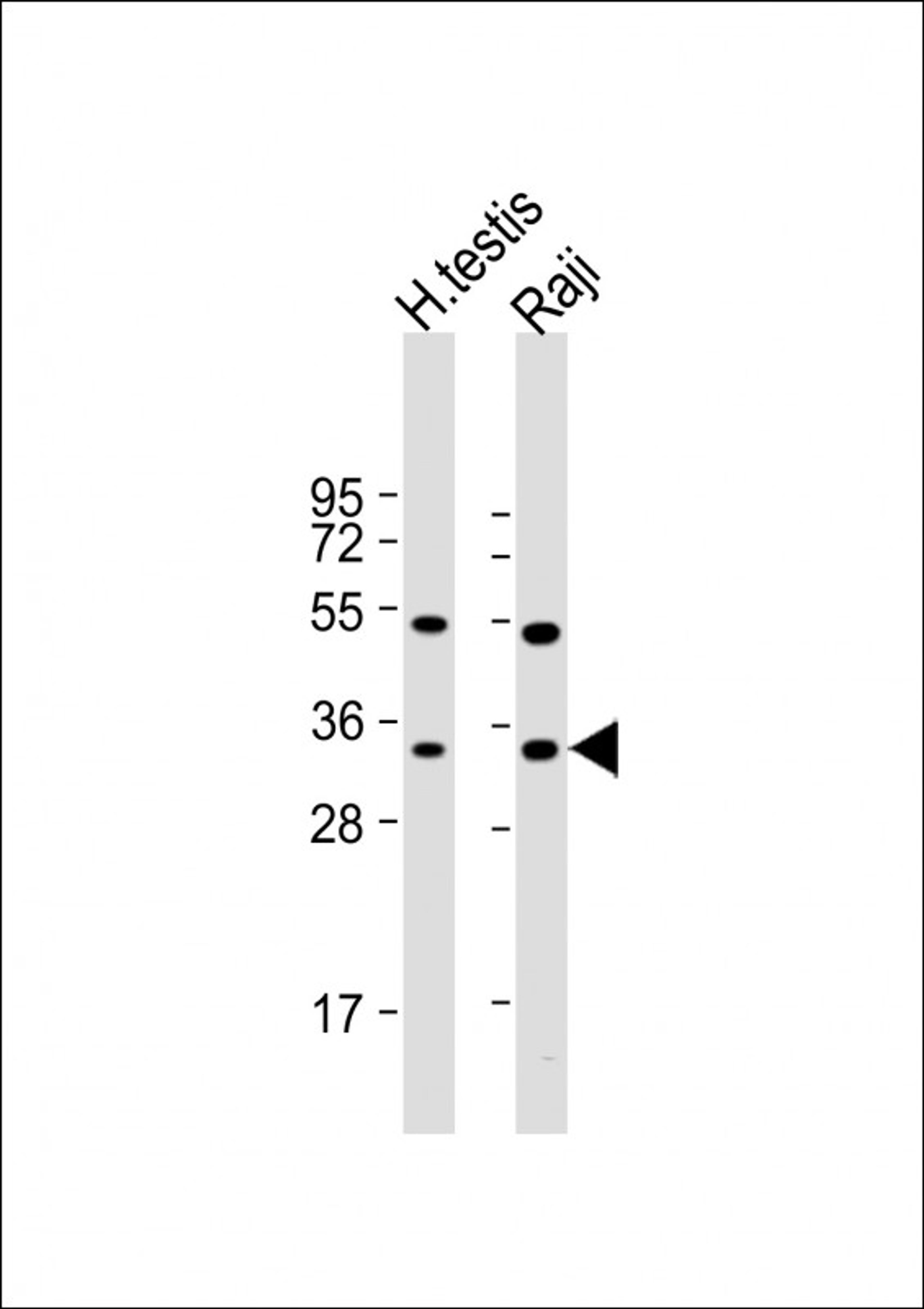 Western Blot at 1:1000 dilution Lane 1: human testis lysate Lane 2: Raji whole cell lysate Lysates/proteins at 20 ug per lane.