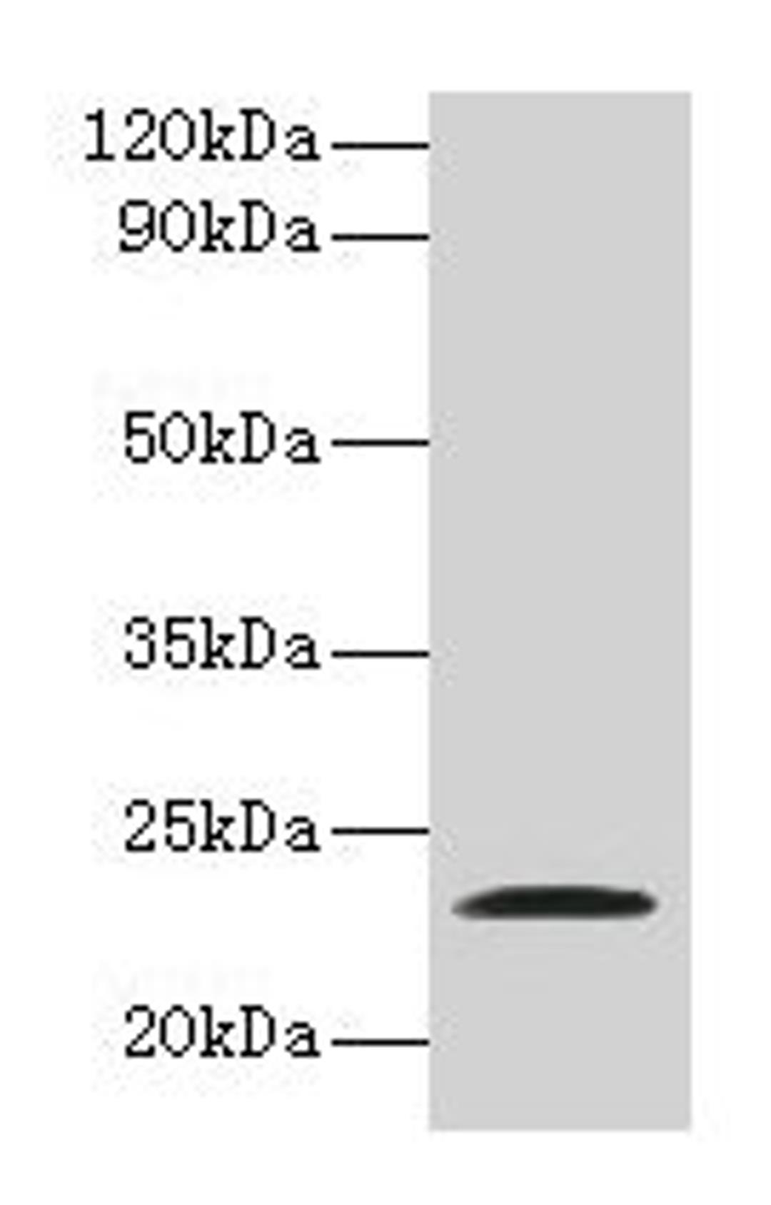 Western blot. All lanes: JAM2 antibody at 2µg/ml + Recombinant Junctional adhesion molecule B protein. Secondary. Goat polyclonal to rabbit IgG at 1/10000 dilution. Predicted band size: 34, 30, 35 kDa. Observed band size: 23 kDa