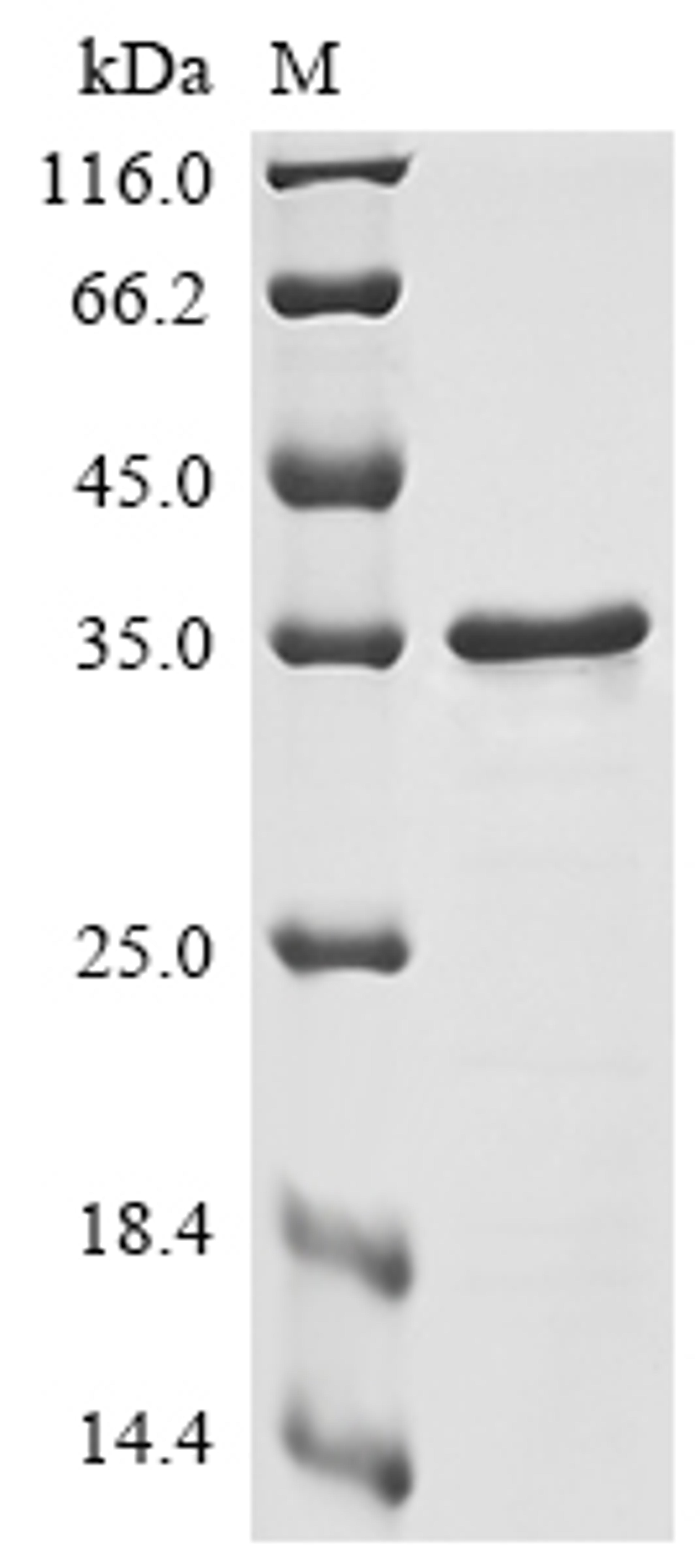 (Tris-Glycine gel) Discontinuous SDS-PAGE (reduced) with 5% enrichment gel and 15% separation gel.