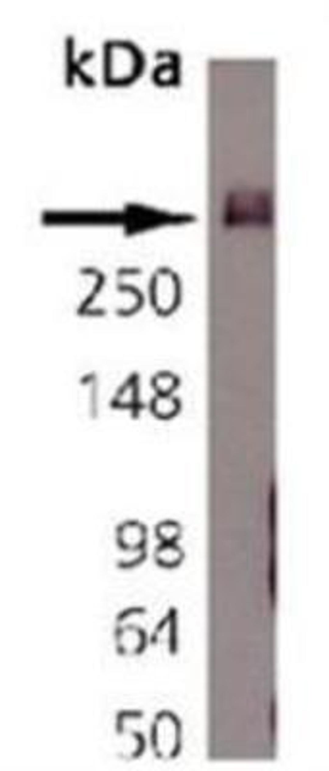 Western Blot: Bassoon Antibody (SAP7F407) [NB120-13249] - Rat brain tissue lysate.