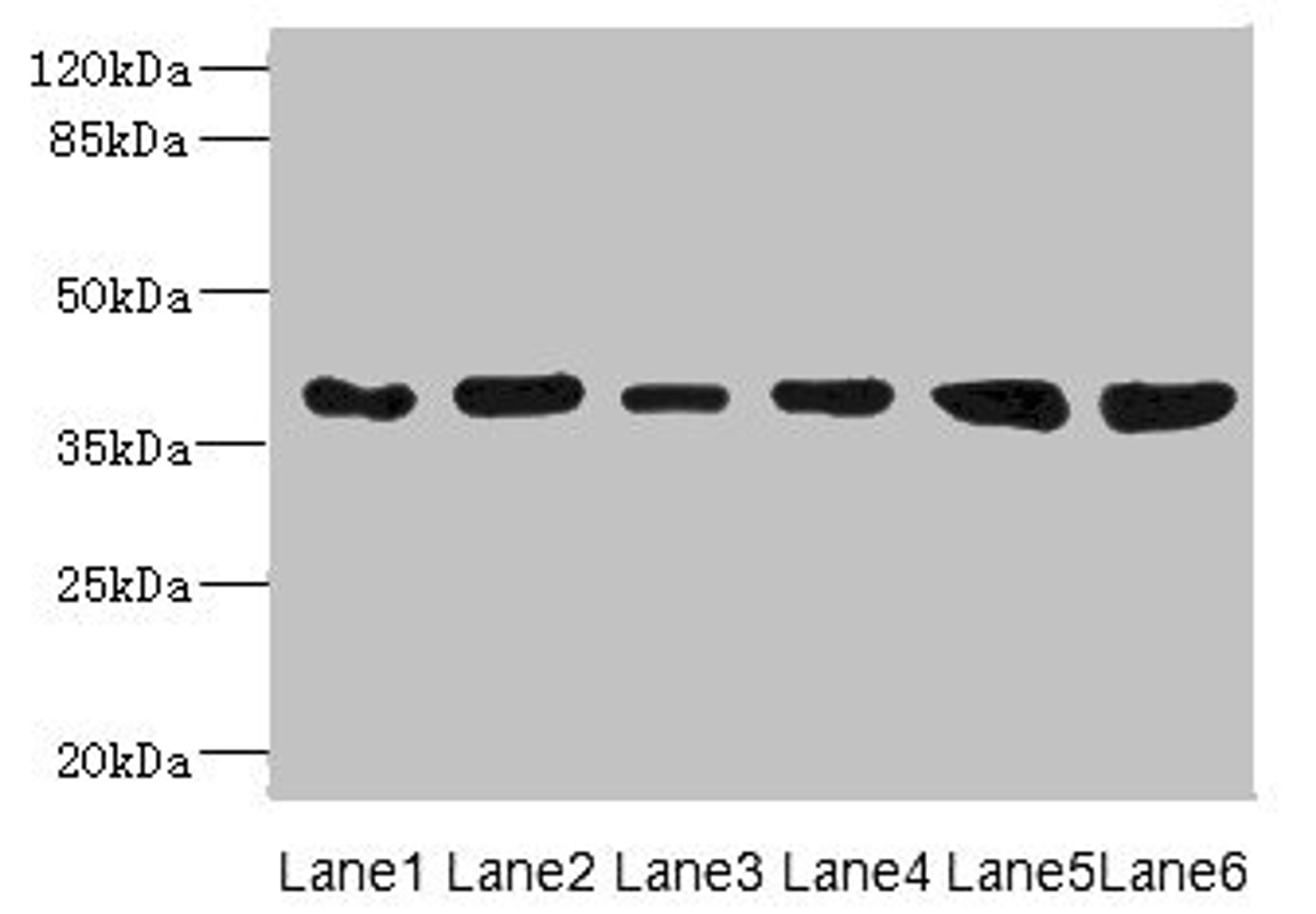 Western blot. All lanes: TIMM50 antibody at 4.05µg/ml. Lane 1: Rat heart tissue. Lane 2: MM231 whole cell lysate. Lane 3: MCF-7 whole cell lysate. Lane 4: Hela whole cell lysate. Lane 5: 293T whole cell lysate. Lane 6: HepG2 whole cell lysate. Secondary. Goat polyclonal to rabbit IgG at 1/10000 dilution. Predicted band size: 40, 51, 28 kDa. Observed band size: 40 kDa