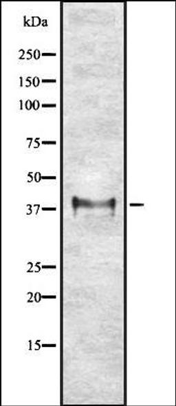 Western blot analysis of K562 whole cell lysates using ETV2 antibody