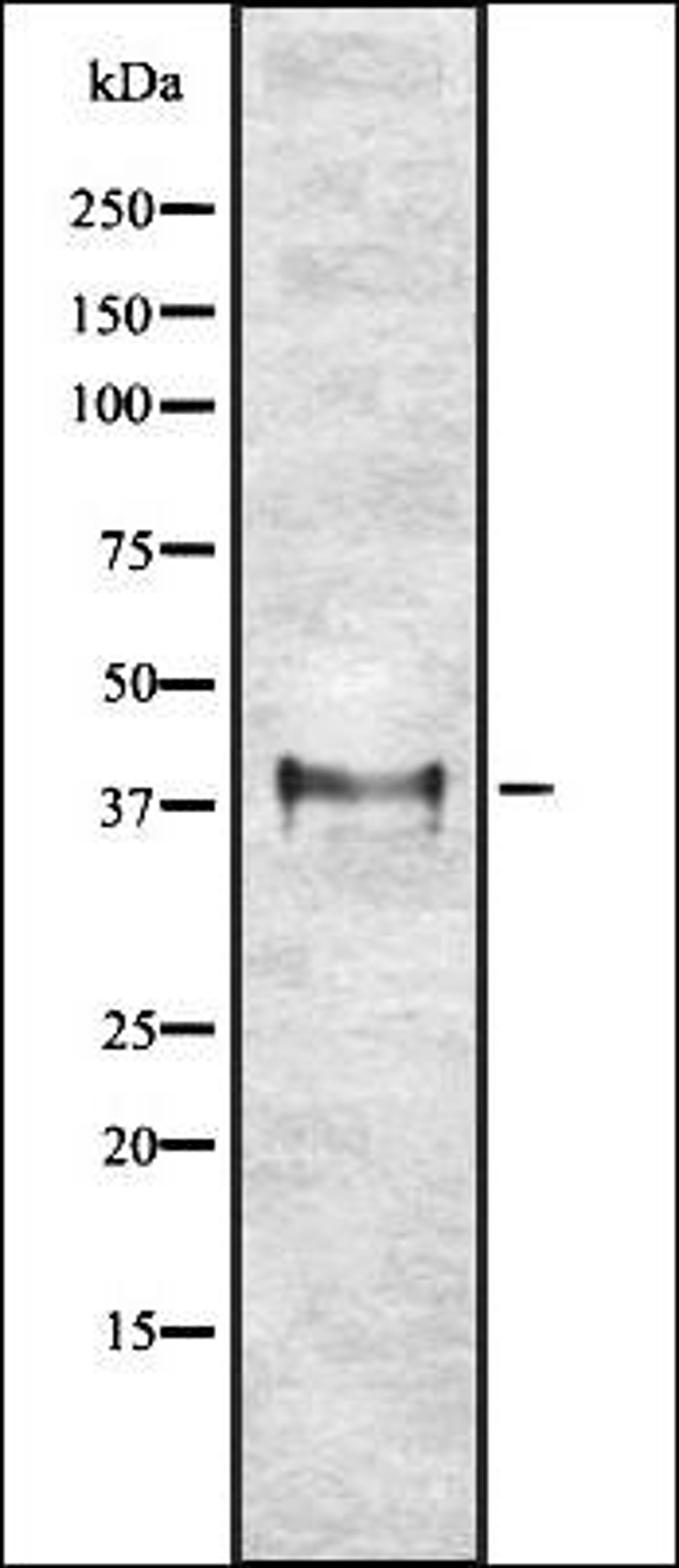 Western blot analysis of K562 whole cell lysates using ETV2 antibody