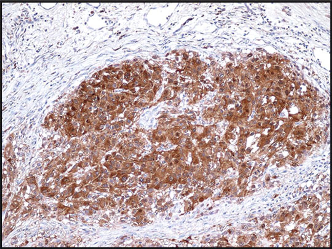 Immunohistochemistry staining of S100A4 in human breast tissue (4 microns) tissue using S100A4 Antibody.