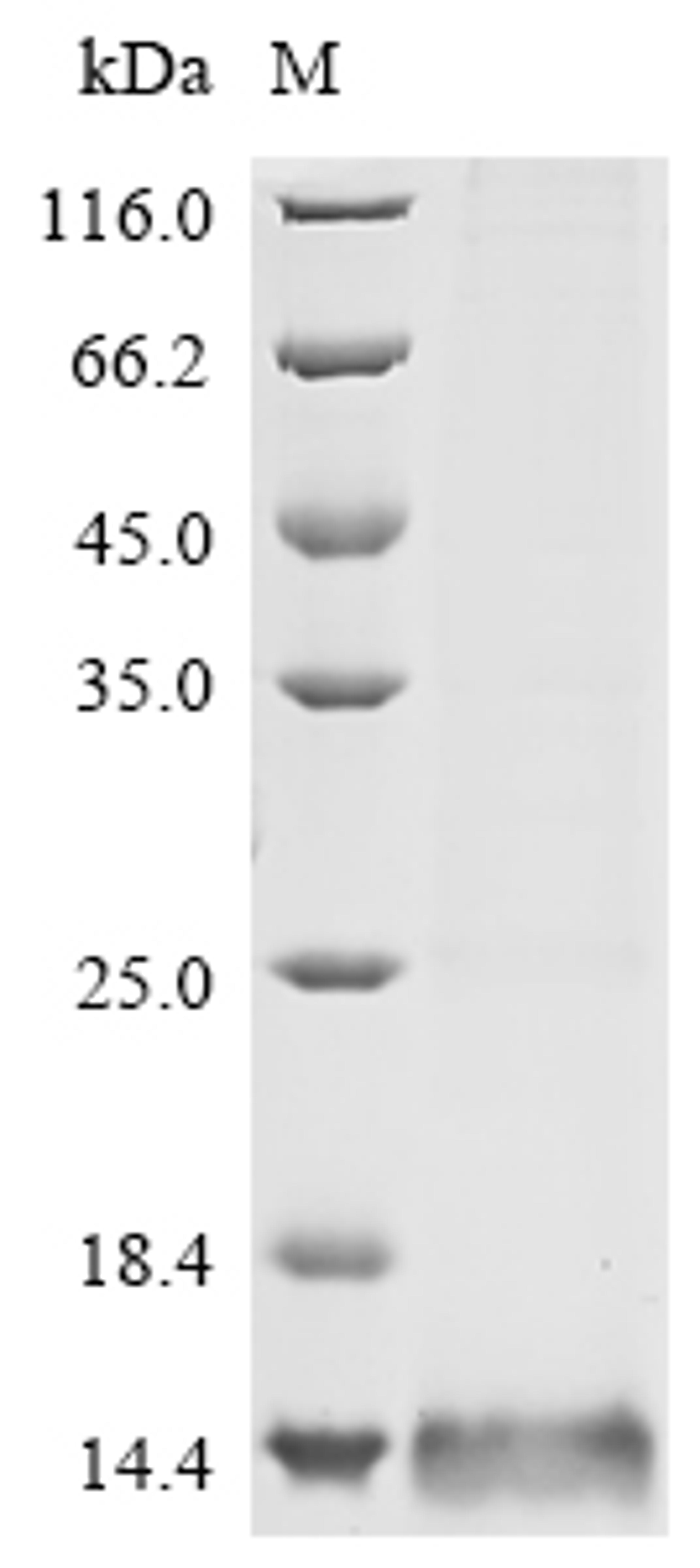(Tris-Glycine gel) Discontinuous SDS-PAGE (reduced) with 5% enrichment gel and 15% separation gel.