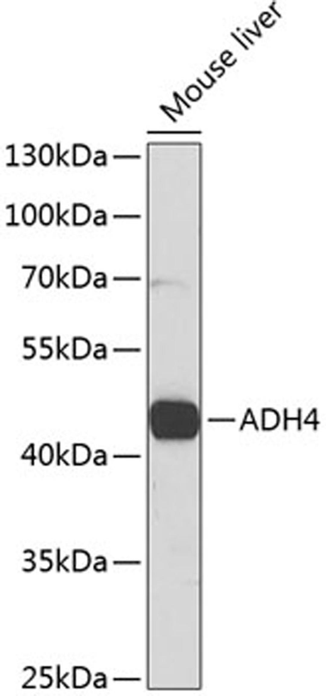 Western blot - ADH4 antibody (A5454)