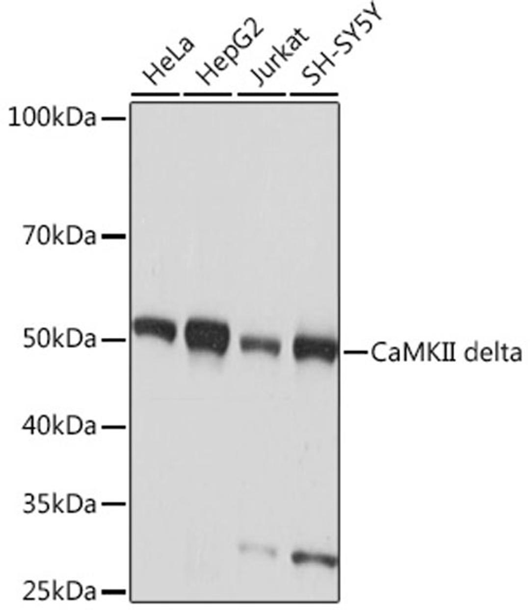 Western blot - CaMKII delta Rabbit mAb (A9196)