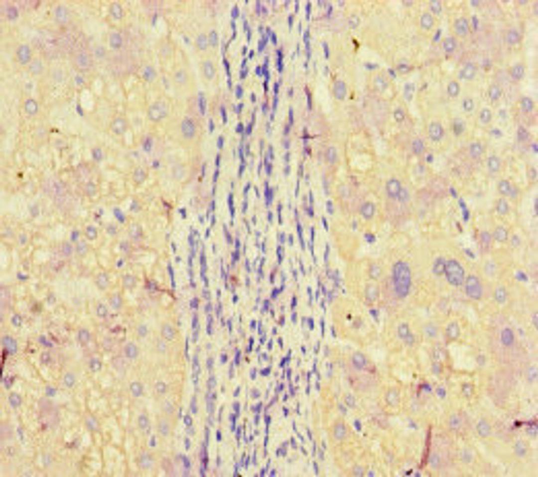 Immunohistochemistry of paraffin-embedded human liver tissue using CSB-PA001926LA01HU at dilution of 1:100