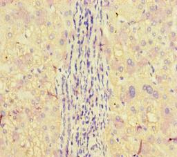 Immunohistochemistry of paraffin-embedded human liver tissue using CSB-PA001926LA01HU at dilution of 1:100